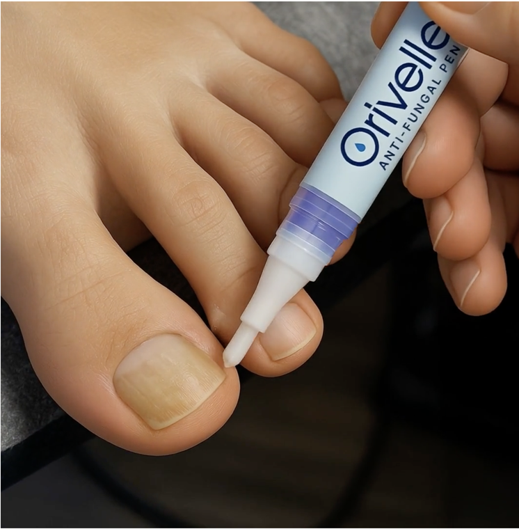 Orivelle Fungus Pen