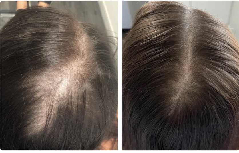 HaloGrow Hair Growth Spray