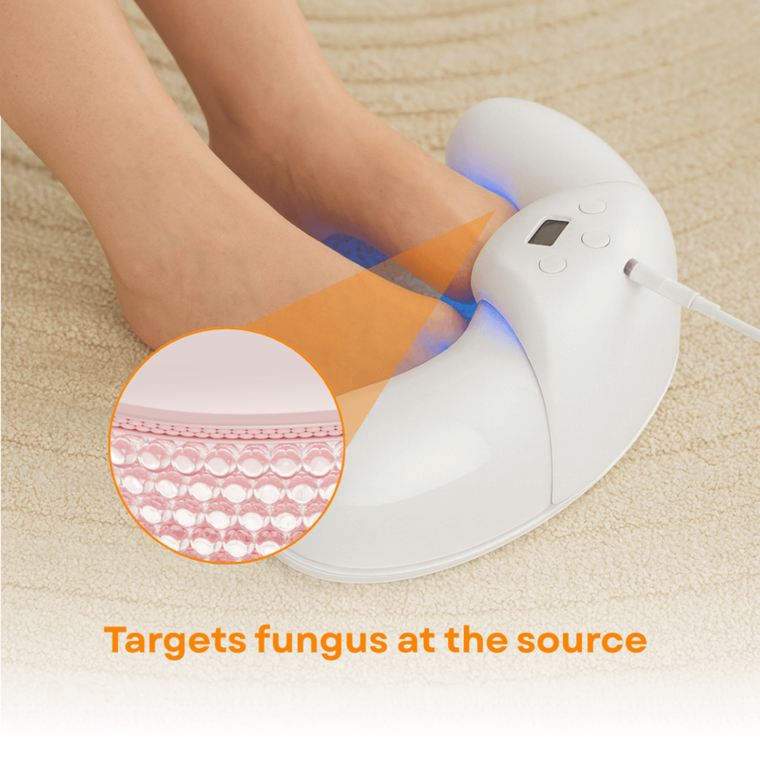 Fungabeam Toenail Fungus Device
