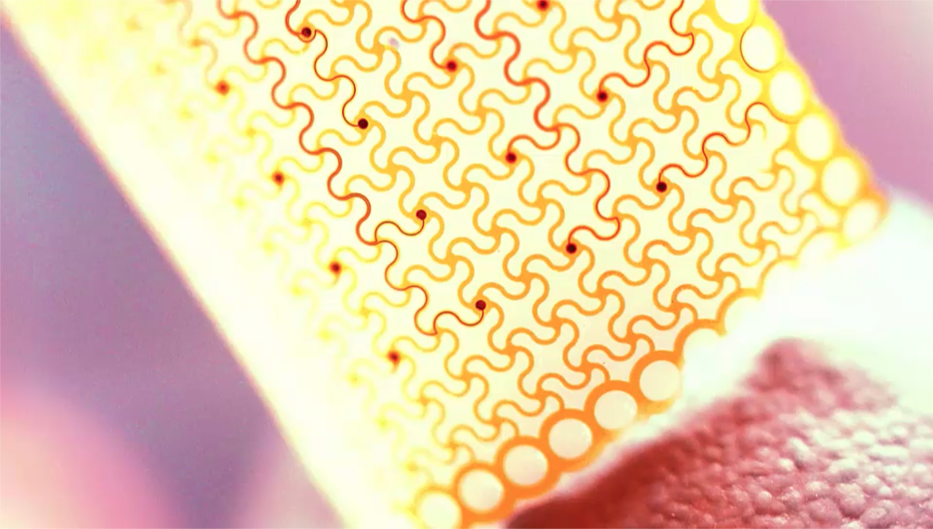 Stretchable Neuromorphic Electronics: UChicago Patch Runs Cardiac AI Without A Server