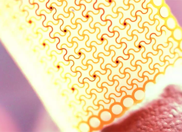 Stretchable Neuromorphic Electronics bioelectronic skin