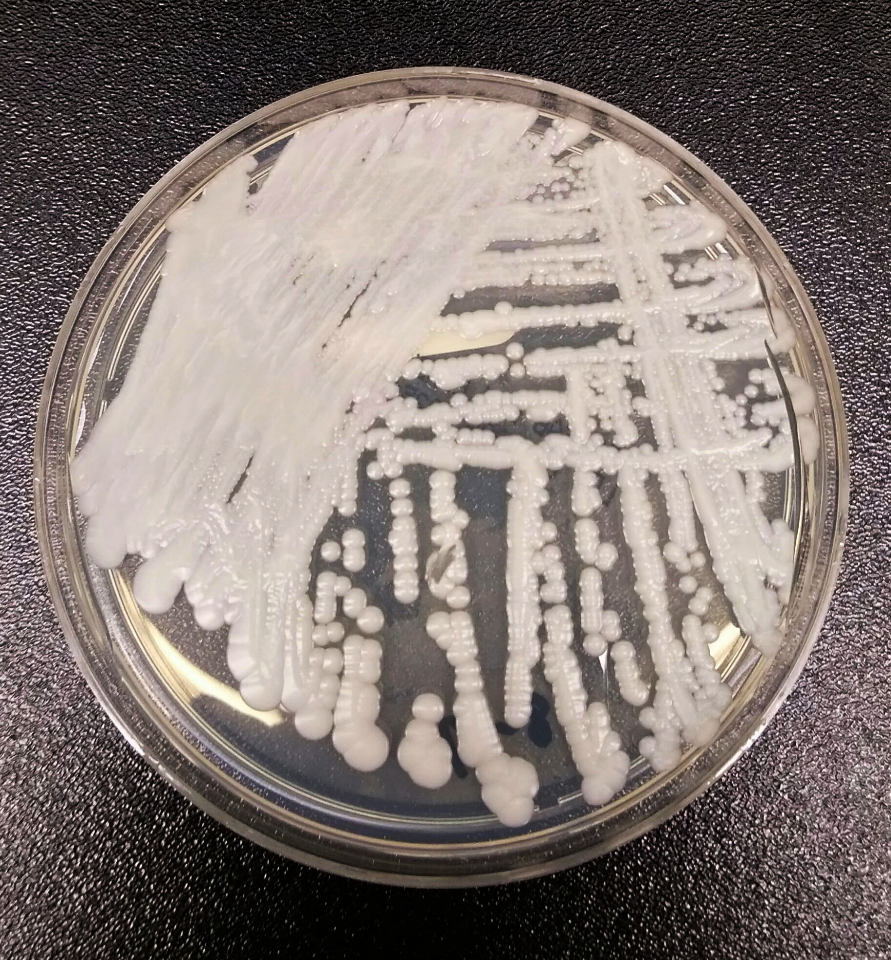 Candida auris Reaches 27 States: Drug Pipeline Stalls as PASTEUR Act Awaits Vote