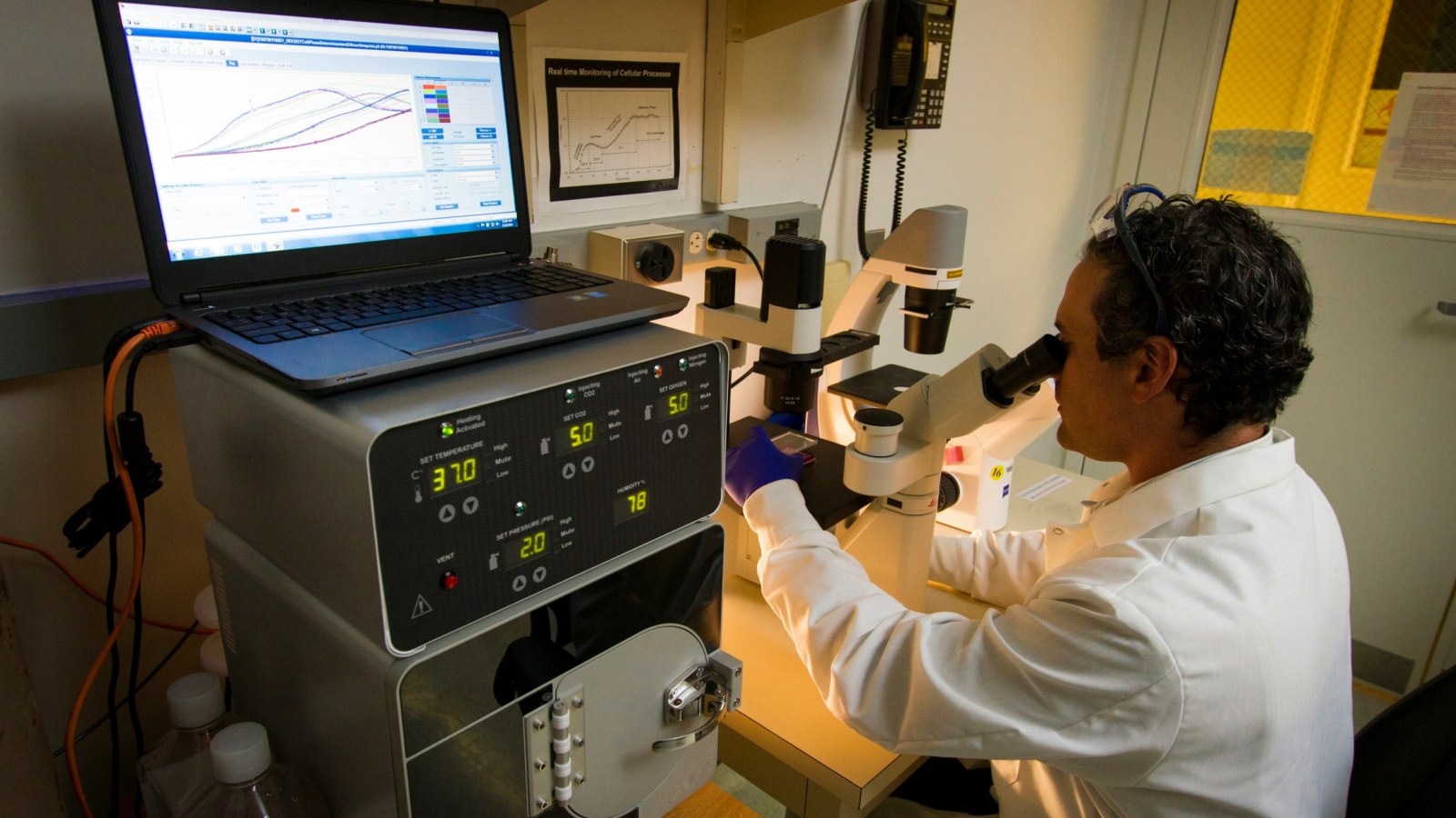 Glycogen Storage Disease Gene Therapy Approved: Cornstarch Data, Not Hypoglycemia Proof