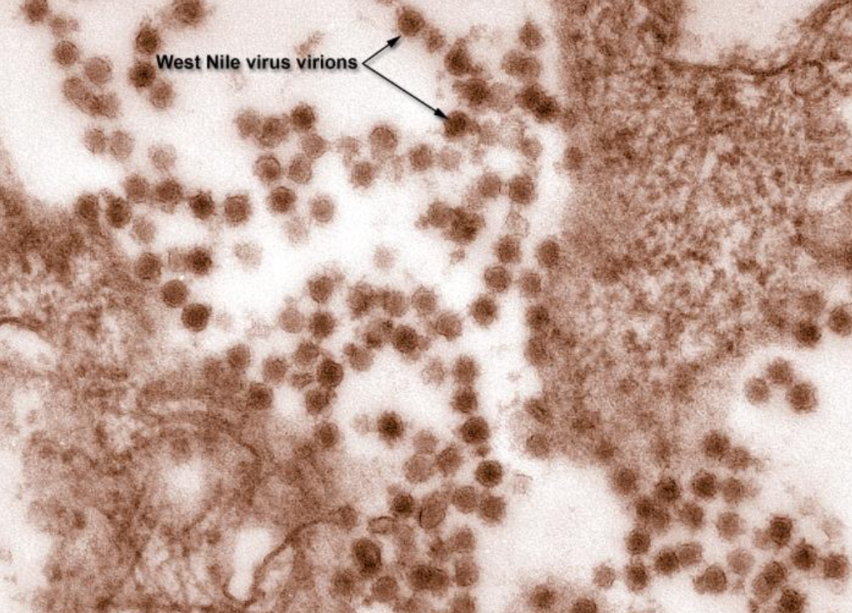 digitally-colorized transmission electron microscopic image revealed presence of West Nile Virus